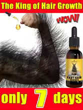 hair growth product, say goodbye to baldness in 7 days. Also effective for beard, ches