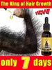 hair growth product, say goodbye to baldness in 7 days. Also effective for beard, ches