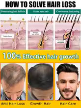 hair growth product, say goodbye to baldness in 7 days. Also effective for beard, ches