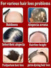 hair growth product, say goodbye to baldness in 7 days. Also effective for beard, ches
