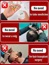 hair growth product, say goodbye to baldness in 7 days. Also effective for beard, ches