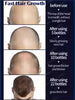 hair growth product, say goodbye to baldness in 7 days. Also effective for beard, ches